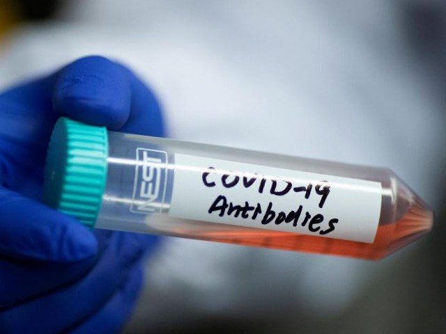 2200630-antibodycoronavirus-1587153083.jpg