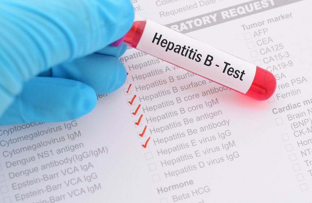 hepatitis-B.png