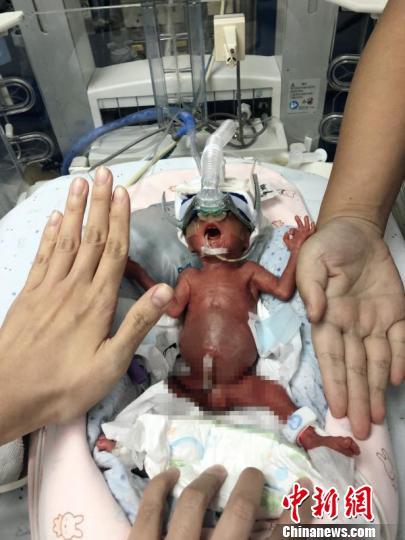 The newborn is only the size of the palm of the palm. [Photo: Chinanews.com]