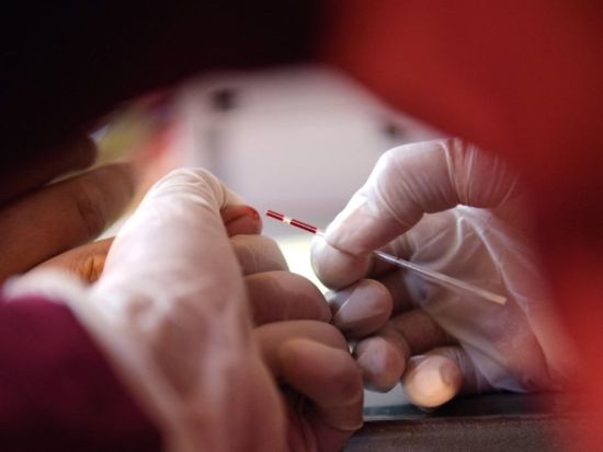 Nearly 700 people die of HIV/AIDS in Cambodia in 2025