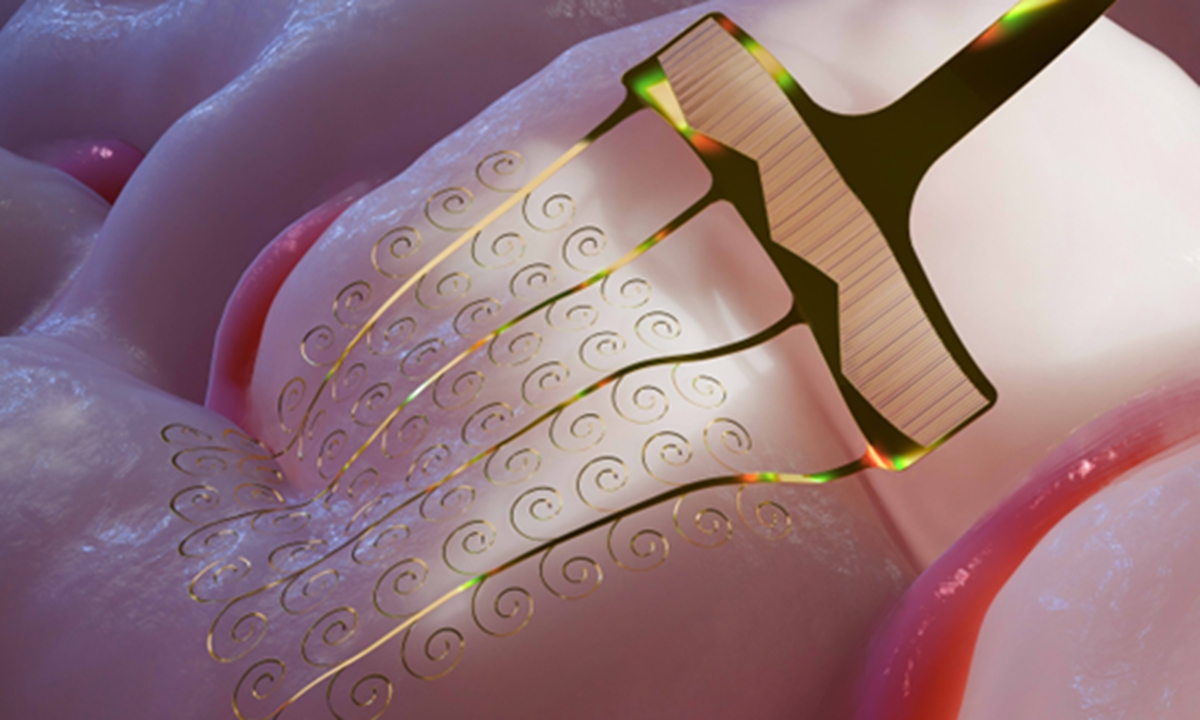Illustration of a high-throughput stretchable flexible microelectrode. Photo: Courtesy of BCIFlex