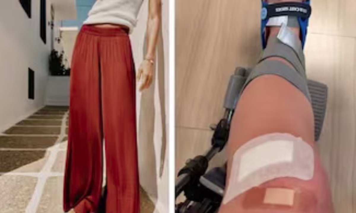A pair of wide-legged pants reportedly caused women consumers to trip while wearing them Photo from social media