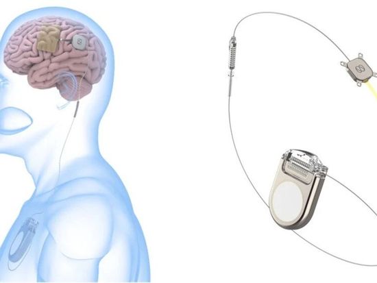 China's first subdural flexible implantable BCI gains fast-track approval pathway