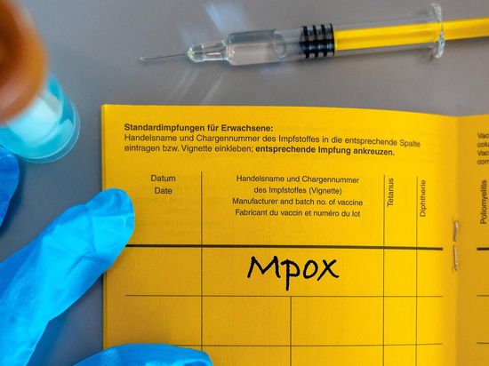 Russia investigates suspected monkeypox outbreak near Moscow