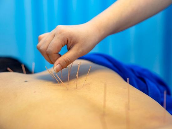 British man promotes Chinese acupuncture in new book, treatments