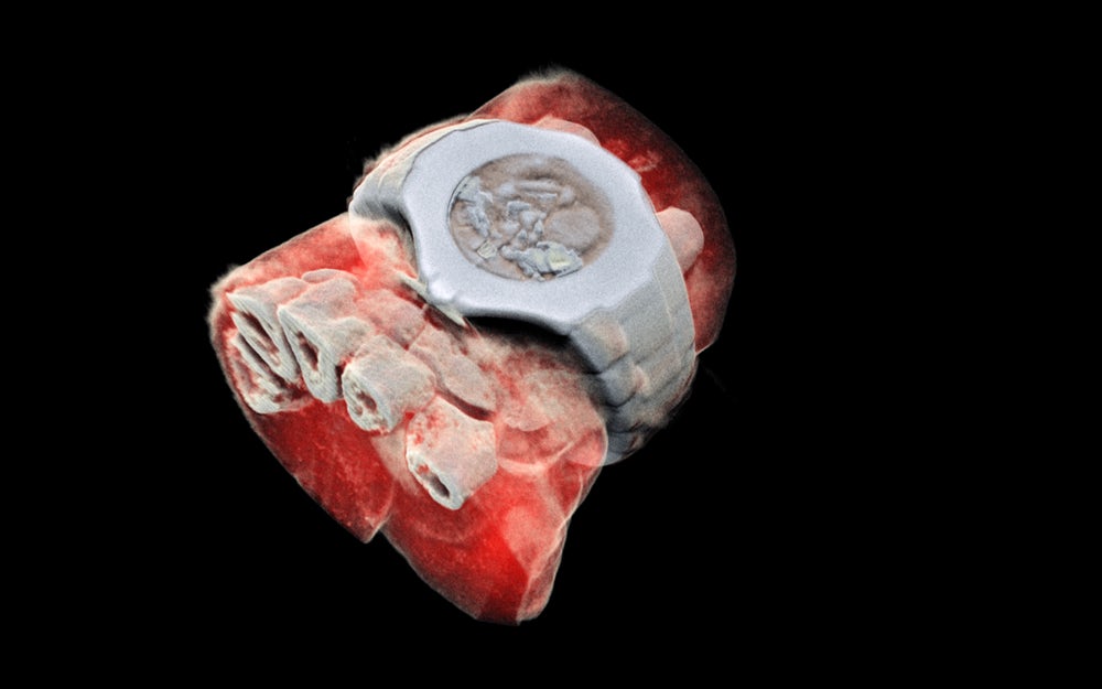 3d-color-xray-2.jpeg