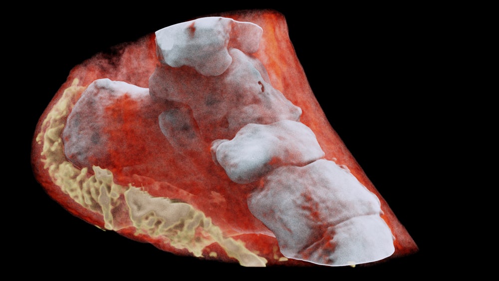 3d-color-xray-4.jpeg